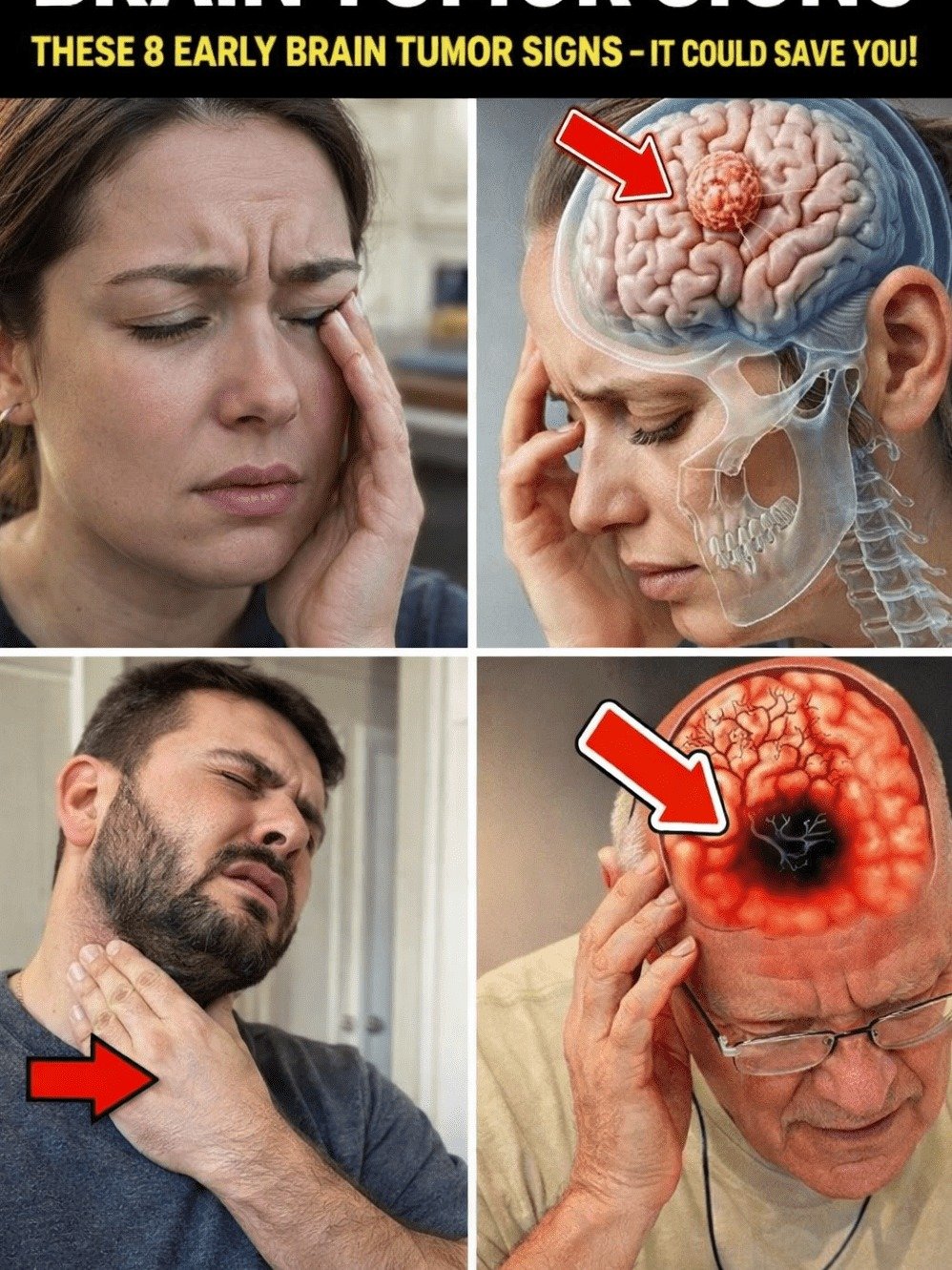 Urgent Warning: 8 Subtle Brain Tumor Signs Doctors Often Miss – Are YOU Experiencing Them?