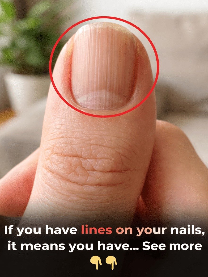WARNING: Your Nails Are Sending Secret Health Signals You CANNOT Afford To Miss