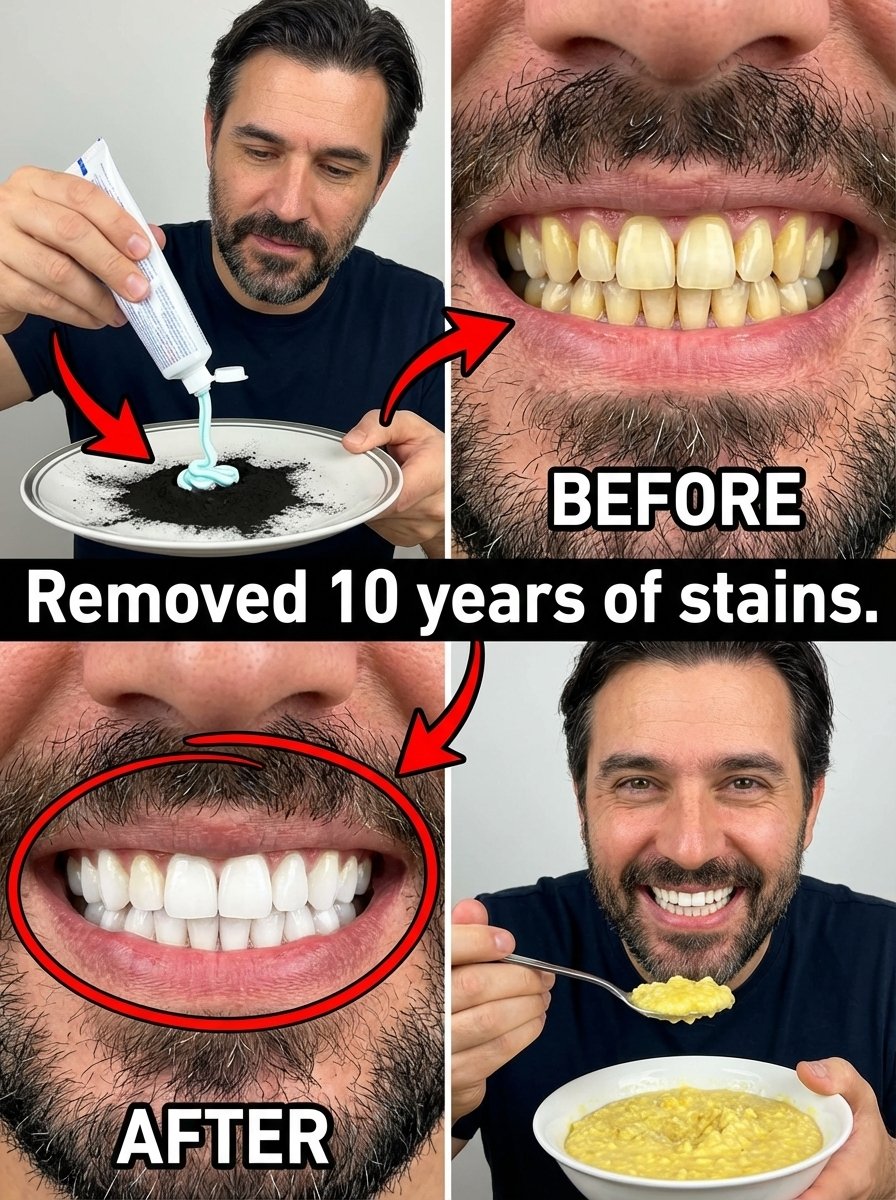 The 2-Minute Kitchen Secret That Wipes Away 10 Years of Teeth Stains – Get Your Dazzling Smile Back (Before You Try Anything Else!)