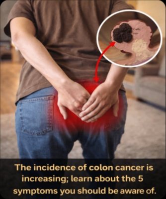 Don't Scroll Past This: 5 Colon Cancer Signs Exploding in Young Adults – Plus The #1 Habit to Cut Your Risk!