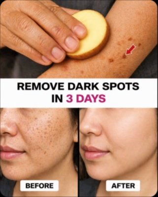 The Shocking Daily Habit That Vanishes Age Spots & Melasma (Plus 9 Natural Secrets for Flawless Skin!)