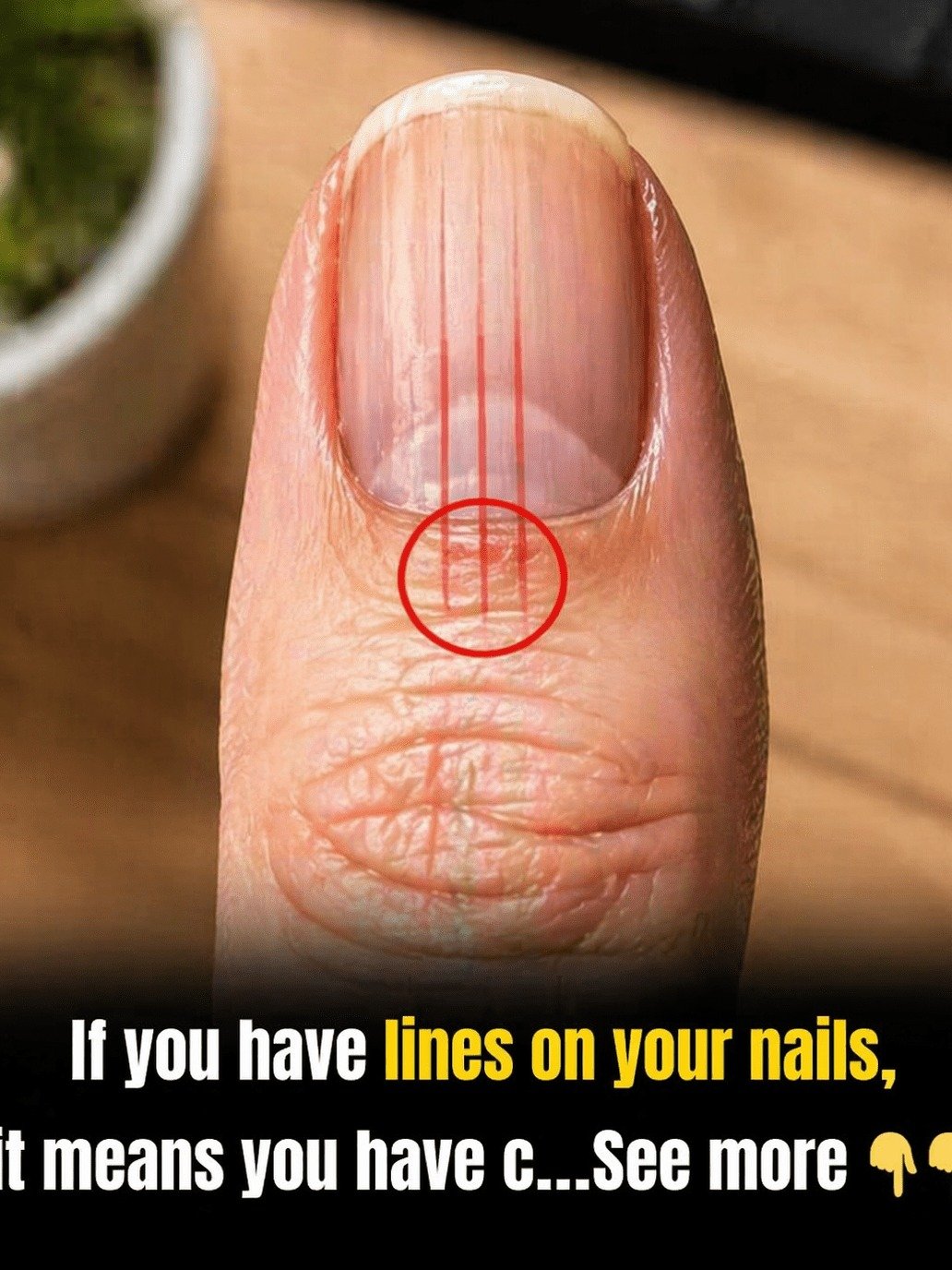 Your Nails Are Sending You Secret Health Signals: What Those Lines REALLY Mean (And Why You Can't Afford To Miss Them!)