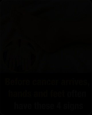 4 Silent Signals Your Hands & Feet Are Sending: Hidden Warnings You CANNOT Afford to Miss!