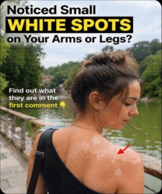 Your Skin's SOS: Why White Spots Appear & The #1 Overlooked Factor You NEED To Know Now!