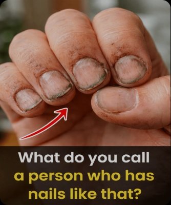 Embarrassed by Your Nails? The Shocking Truth Behind Thick, Yellow Nails (And 7 Steps to Clearer Ones!)