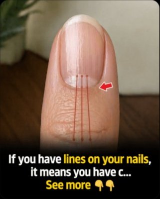 CRITICAL Warning Signs: What Those Lines on Your Nails Are REALLY Telling You About Your Health (Don't Miss This!)