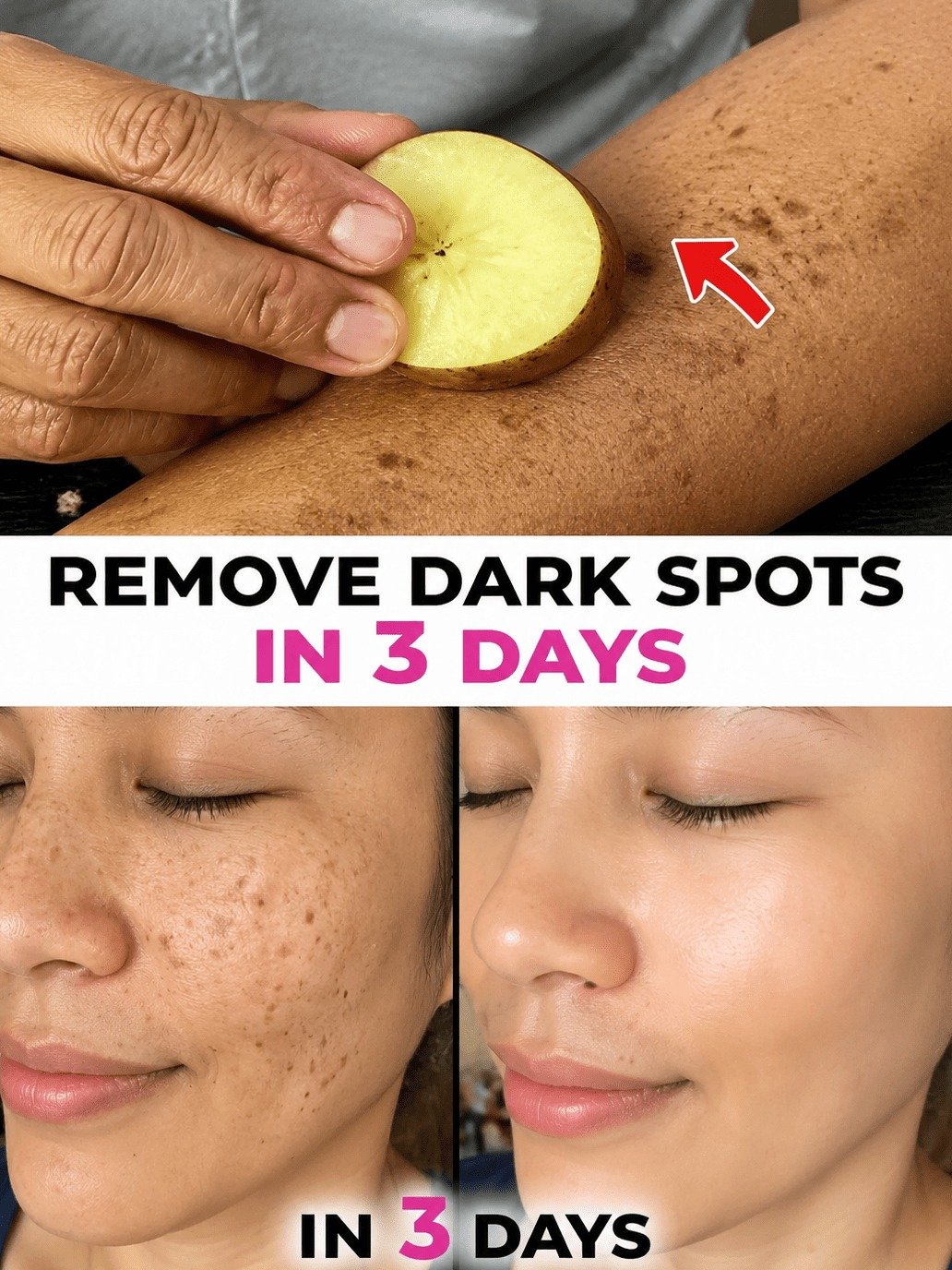 The Untold Secret to Erasing Stubborn Age Spots & Melasma Naturally (Without Harmful Chemicals!)