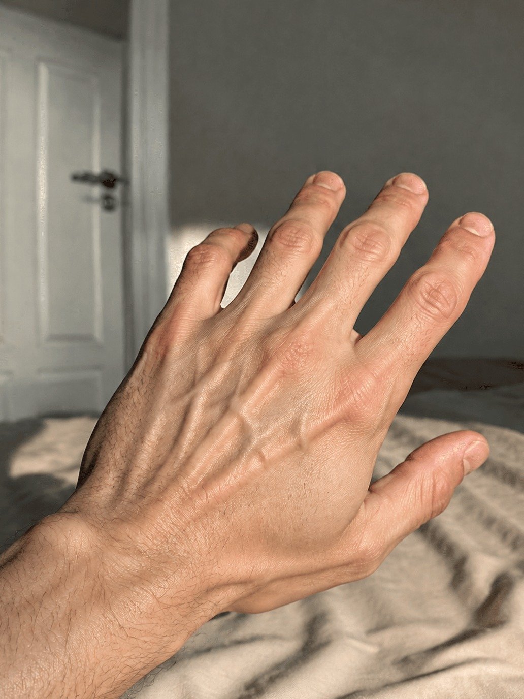 Why Are Your Hand Veins Suddenly Bulging? 5 Hidden Truths You Can't Afford To Miss!