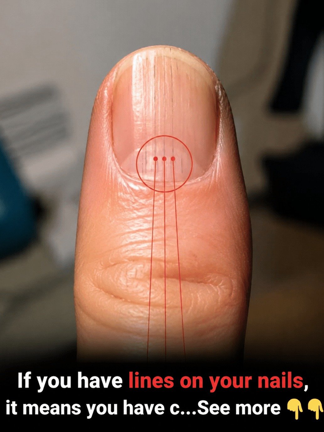 STOP Ignoring Your Nails: What The Lines On Your Fingertips Are REALLY Trying To Tell You About Your Health