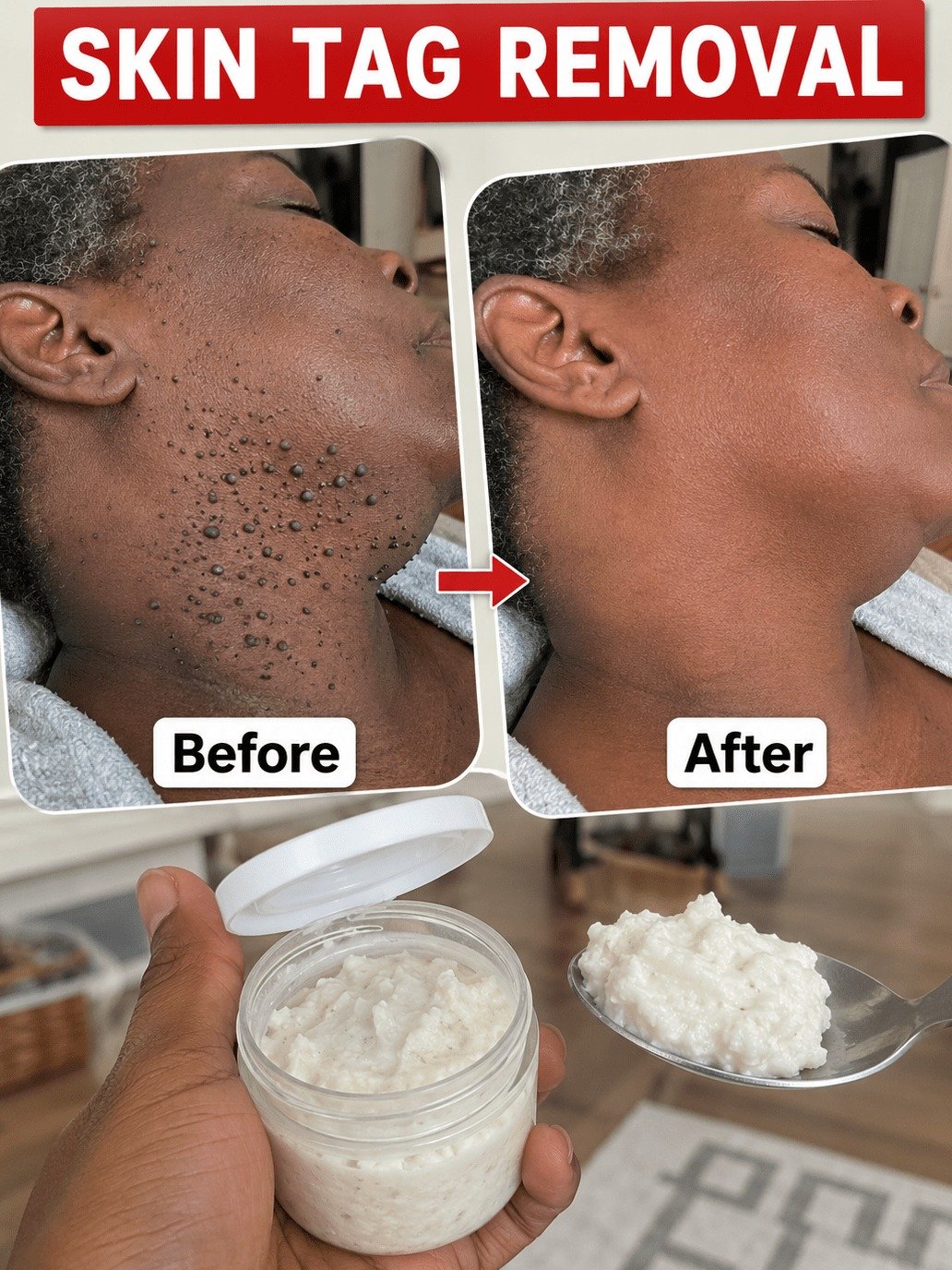 The *Viral* Overnight Skin Tag Fix Dermatologists Actually Recommend (Don't Miss This!)