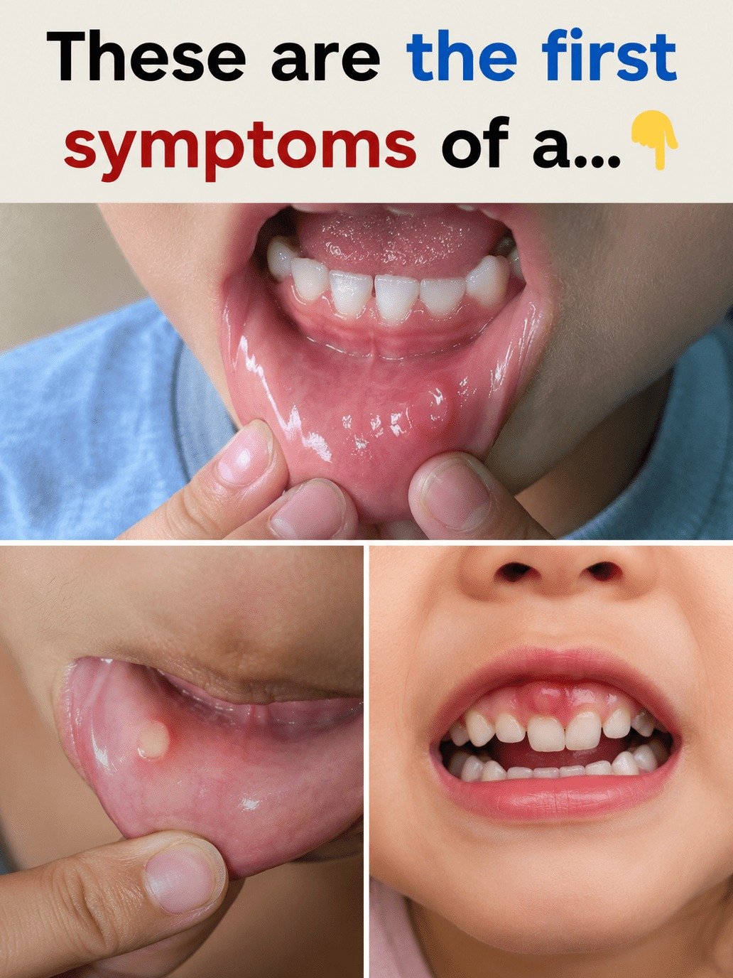 YOUR MOUTH IS WARNING YOU! 7 Secret Signs of Oral Cancer You CANNOT Afford to Ignore