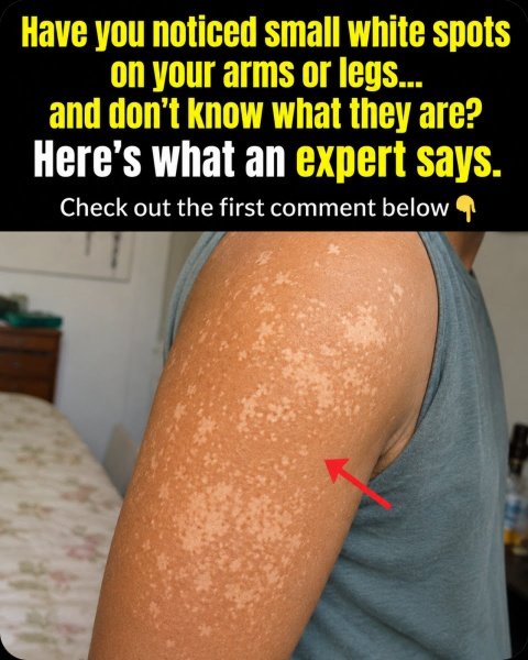 Decoding Your Skin: The 5 Hidden Reasons for White Spots You NEED to Know Now (Before It's Too Late!)